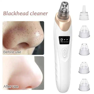 Derma Suction Blackhead Acne Oil Remover